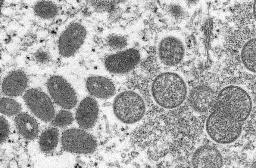 Germany, France, Belgium confirm first cases of monkeypox