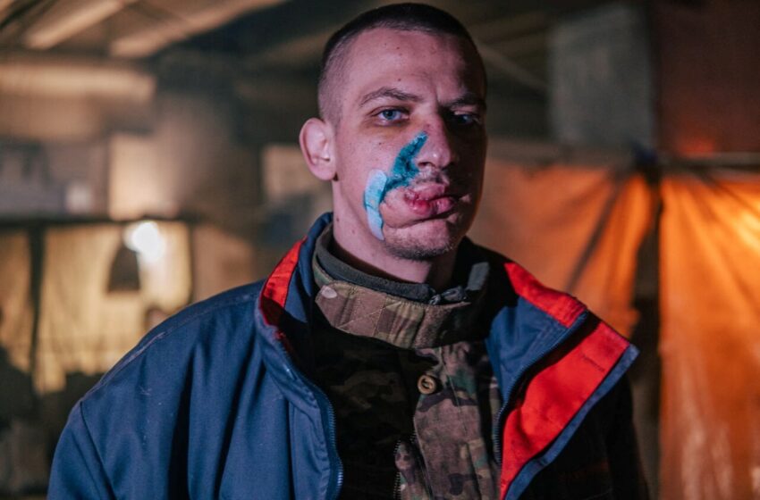  Mariupol fighters — faces bruised, limbs missing — plead for rescue