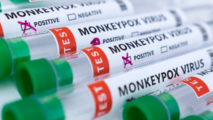  US to declare monkeypox’s outbreak as health emergency